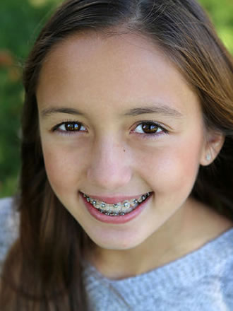 early orthodontic treatment